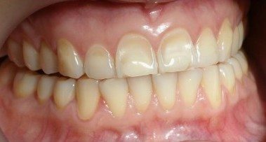 Teeth | Kedron Family Dental